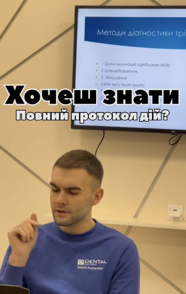 Основні питання: протокол. Курси з ендодонтії Львів