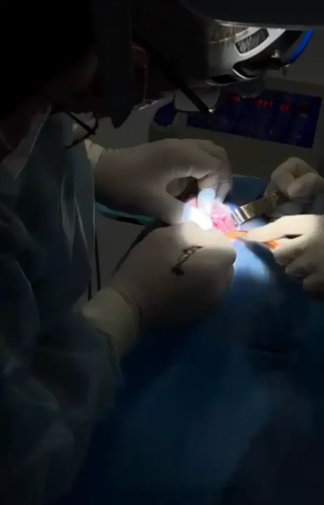 Реальний пацієнт на курсі з синус-ліфтингу в DentalKnysh, фото