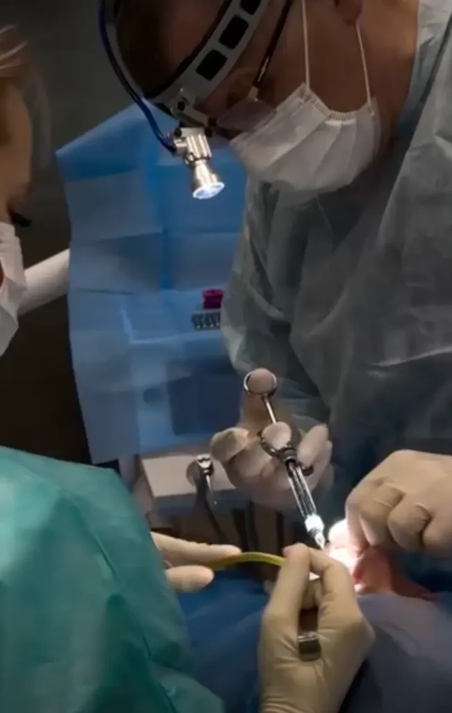 Практична частина курсу з синус-ліфтингу в DentalKnysh, 2026-04-28, відео